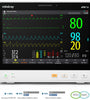 Mindray ePM 12 Patient Monitor